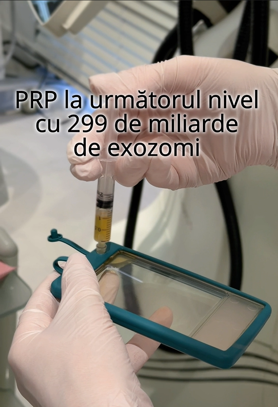 Aparatul MCT — lumina albastră — Clinica Mostelle