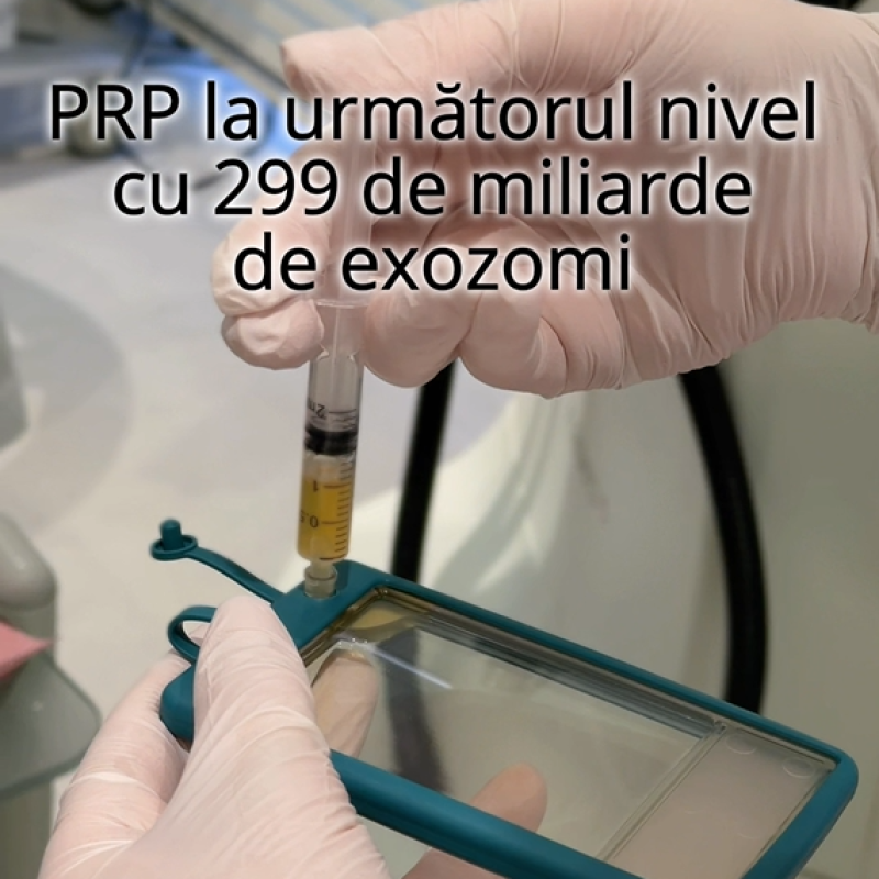 Captură de ecran 2026-03-24 213927